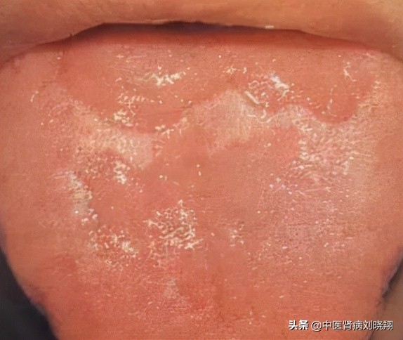 刘主任让病人伸舌头，看的是什么？