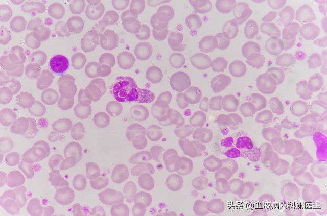 白细胞减少红细胞增多有什么危害,减少白细胞的方法