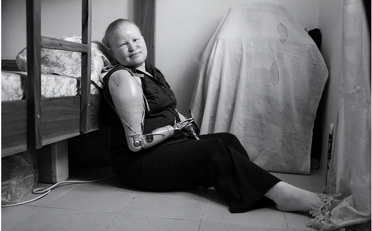 非洲最特殊的人群：血液堪比黄金，遗骸卖上百万，却无法健康成长