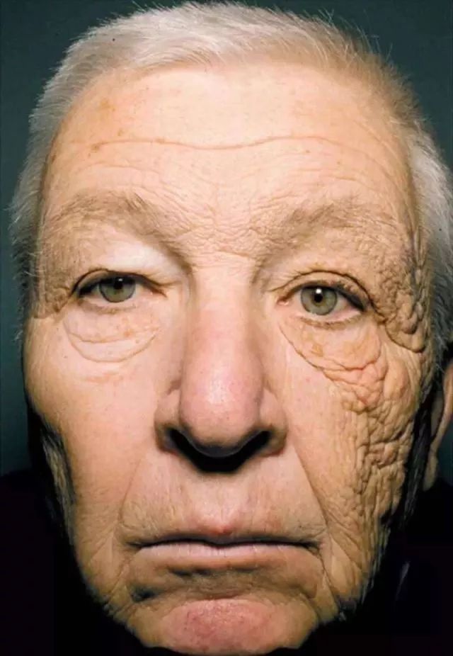 爆红的贵妇美白丸,能吃吗?