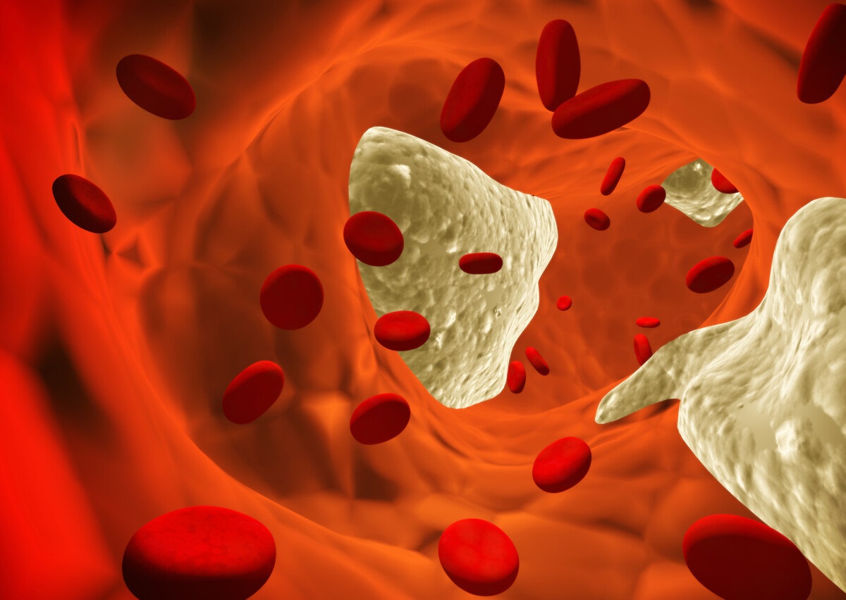 叶酸维生素c可以预防脑梗塞吗,叶酸治疗脑梗塞的最好方法