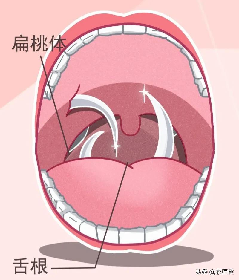 小孩鱼刺卡喉能自愈吗,鱼刺卡喉半年寻医无果