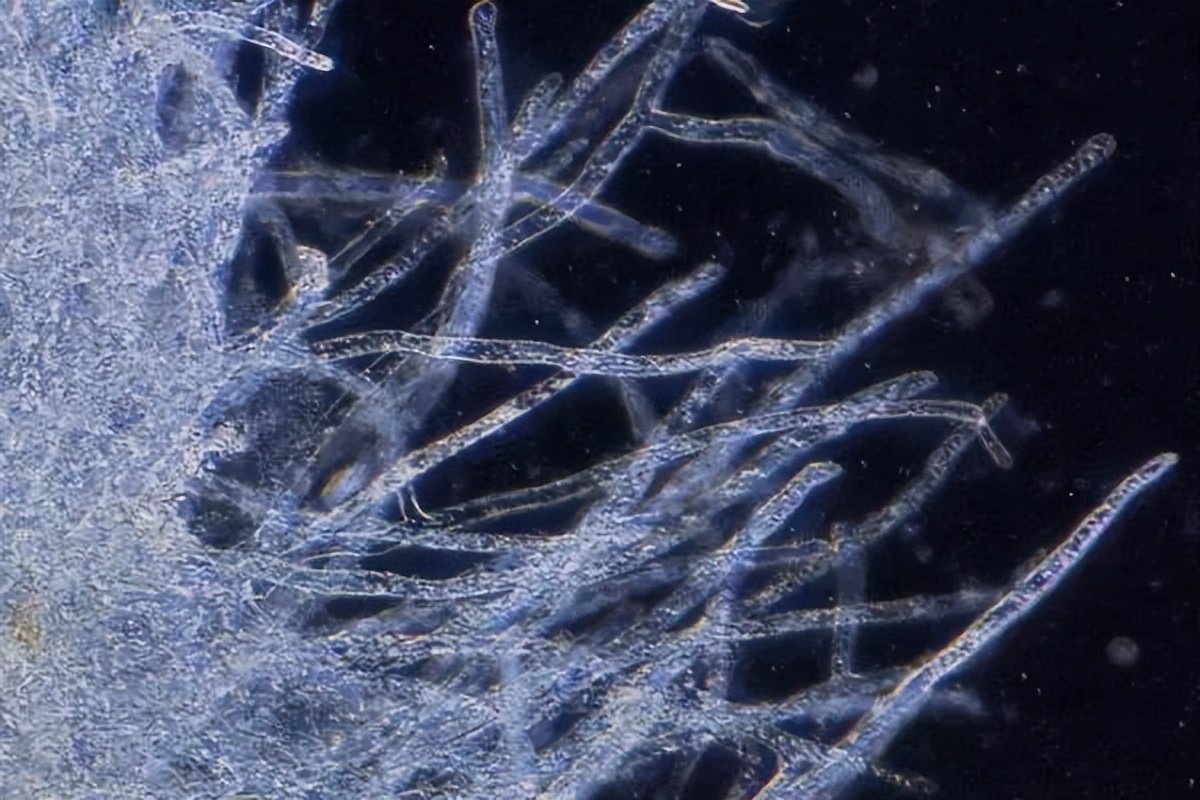 穿上“貂”的鱼处理不当直接翻塘，想要处理彻底看清楚最后两条。