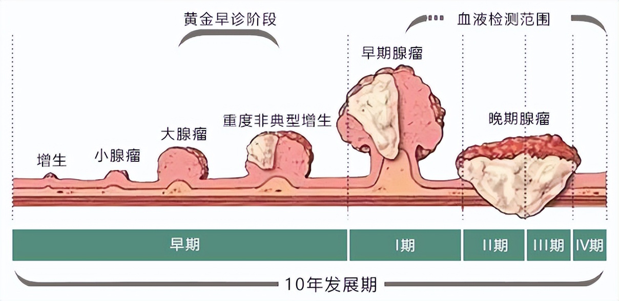 息肉一定会癌症吗,增生息肉切完会癌变吗