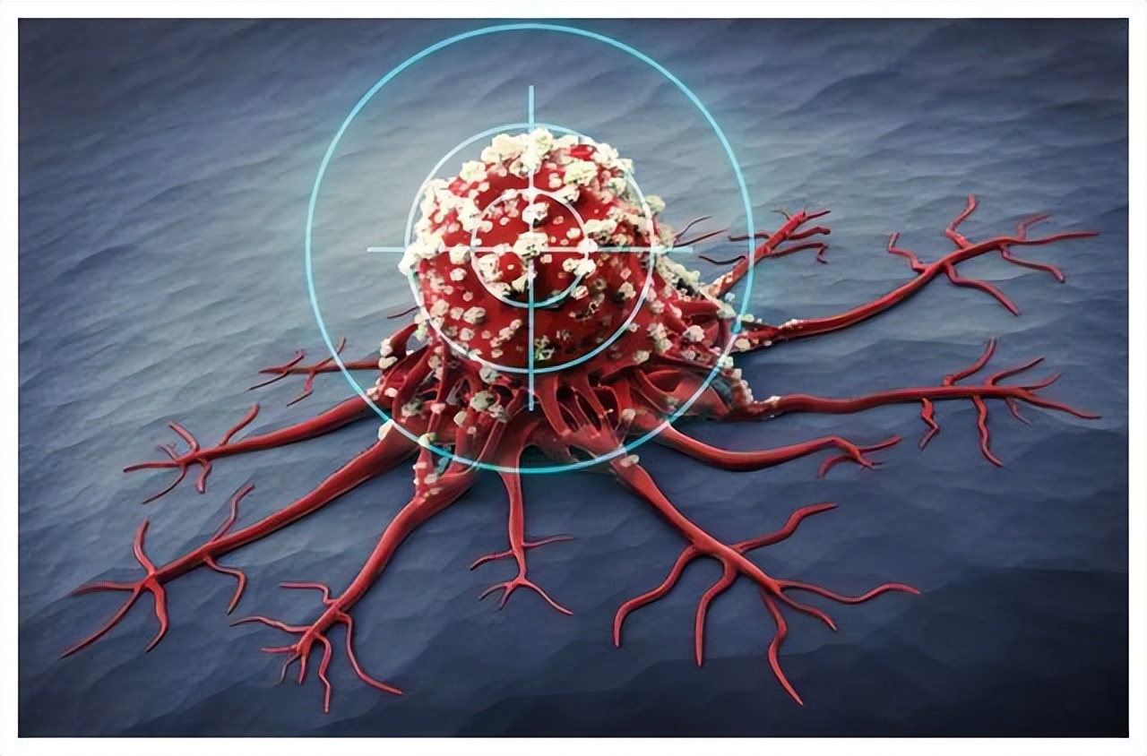 恶性肿瘤患者放疗期间吃点什么好,恶性肿瘤放疗后的注意事项