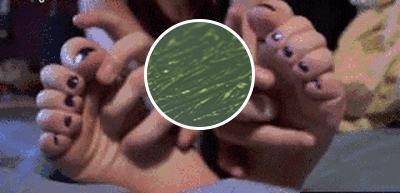 脚趾甲沟炎肿了怎么办一碰就疼,甲沟炎把指甲拔了还是肿