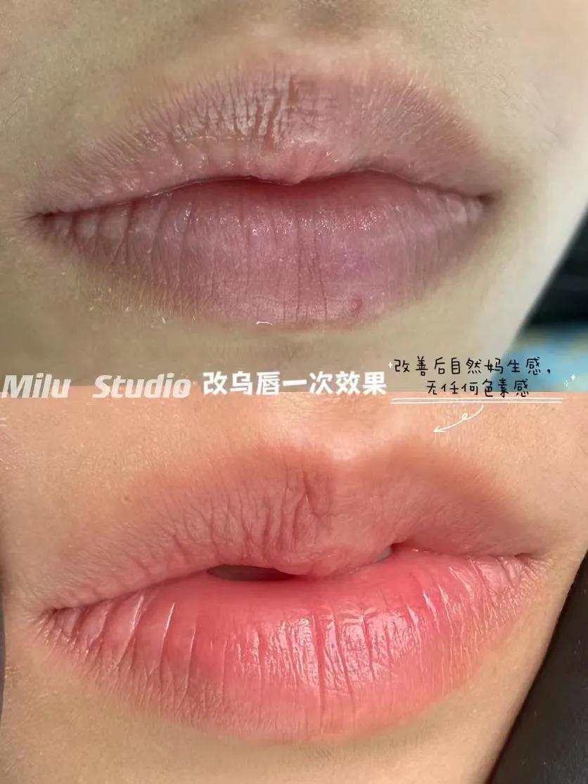 纹唇后怎样护理才能更好反色,新手小白纹唇要准备什么