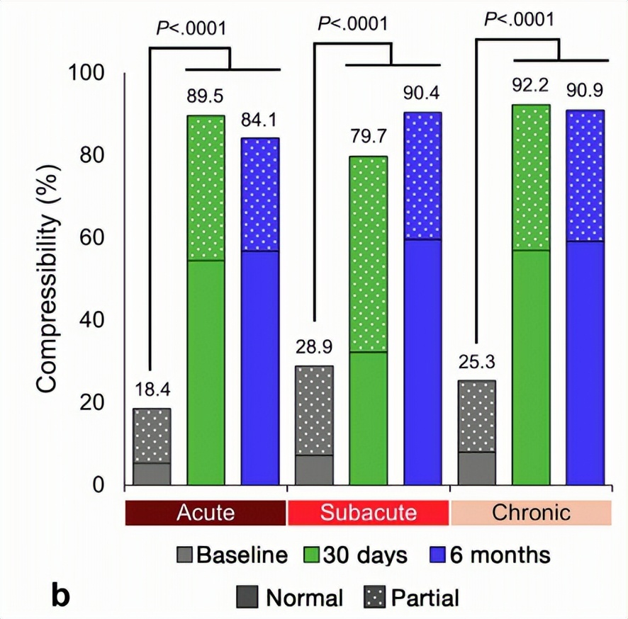 下肢静脉血栓介入全过程,深静脉血栓的一体化治疗