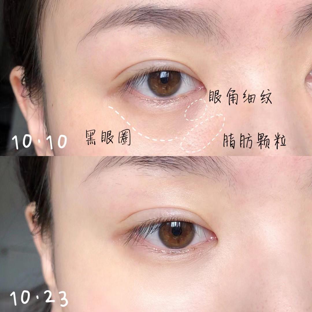 眼霜怎么抹效果好用点,眼霜究竟怎么涂的好用一点