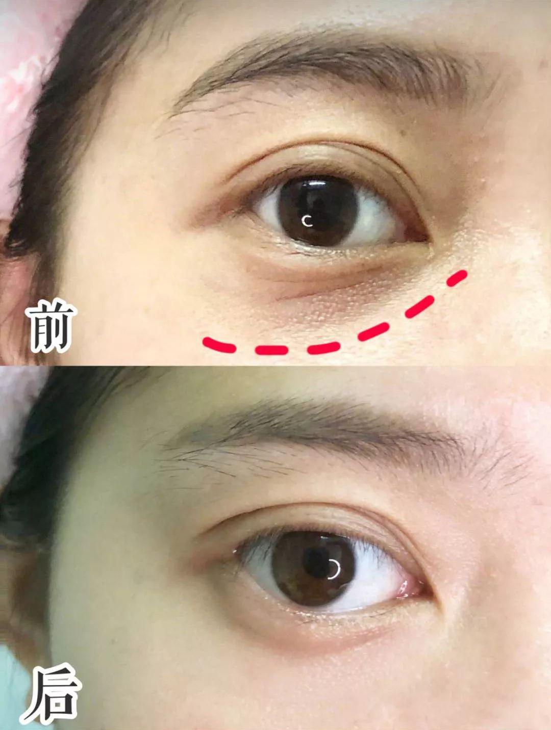 抗老淡纹面霜推荐赫莲娜价格,娇兰赫莲娜水乳哪个好用