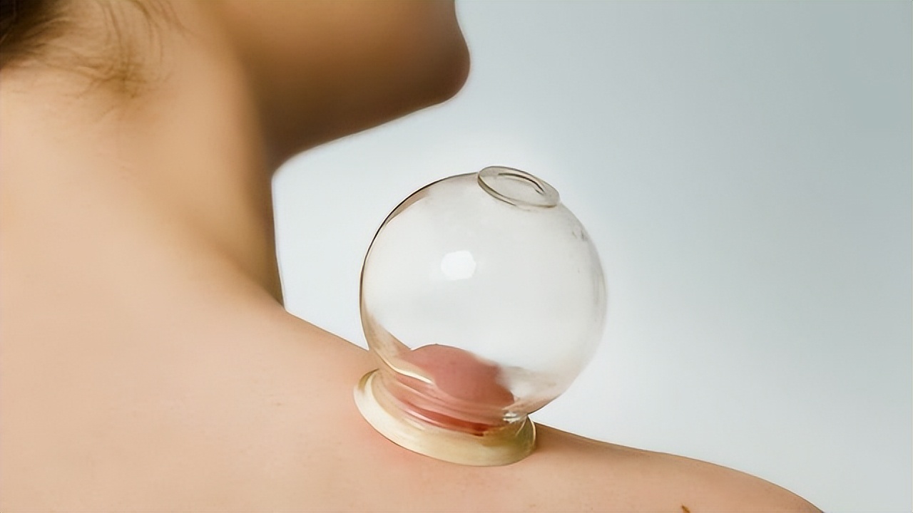 拔火罐吸出来的是湿气还是毒素,拔火罐吸出来的淤血是什么