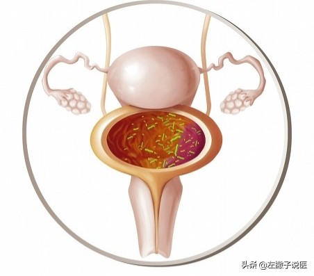 长期裸睡的人，最终会怎样？女子坚持裸睡一个月，收获了5个好处