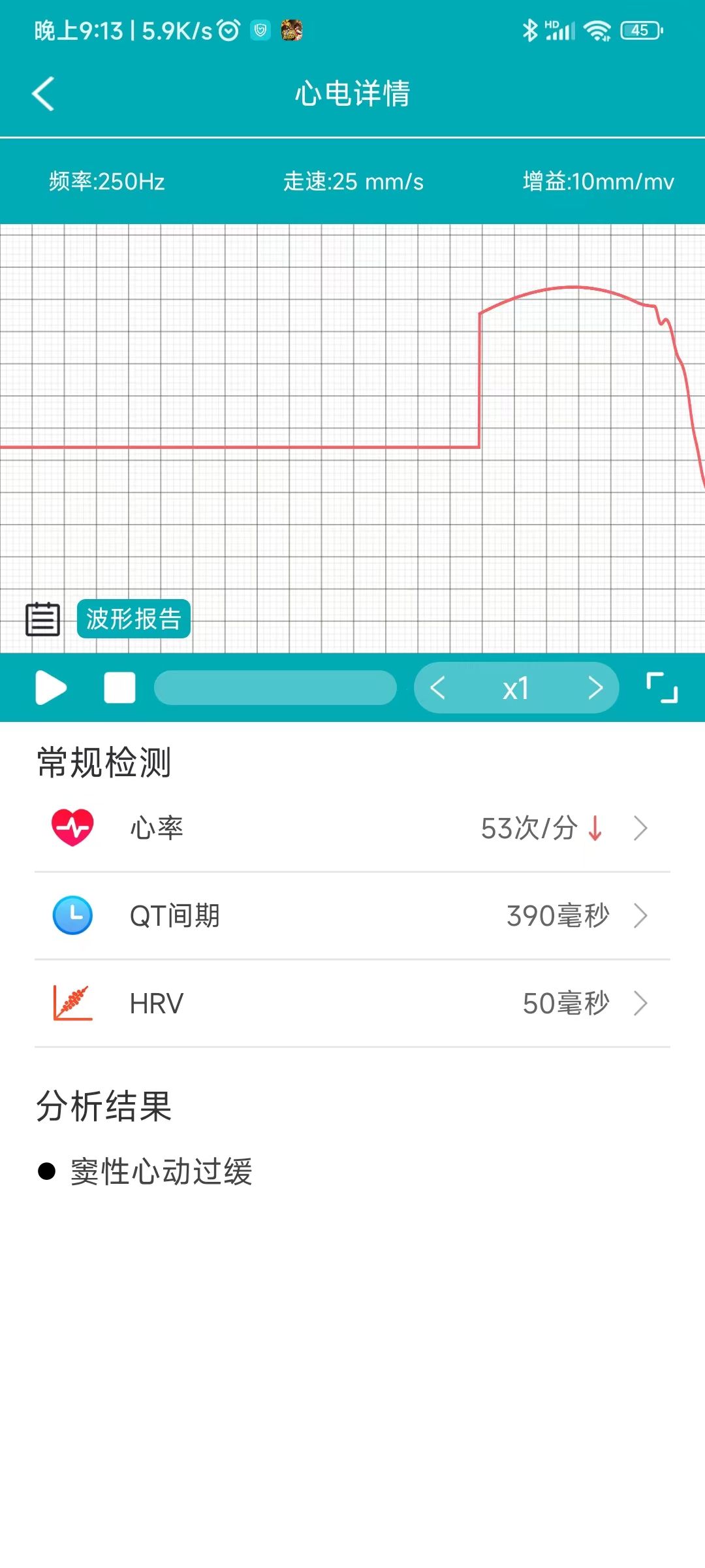 精准实时测心率和血压的智能手环,智能手环血压心率测量戴哪只手好