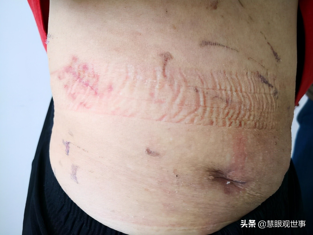 侯海洋基层风云为什么没有了,侯海洋基层风云完整小说