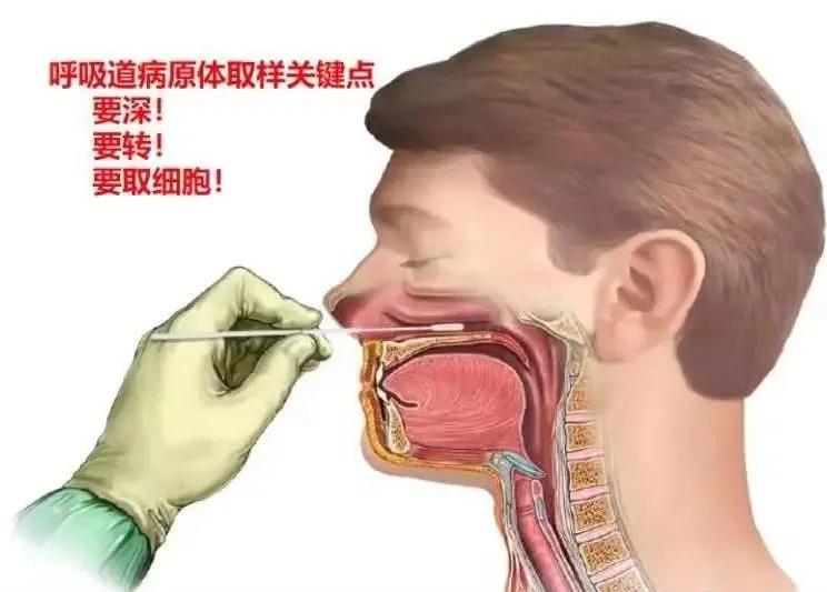 口咽、鼻咽拭子采集标准