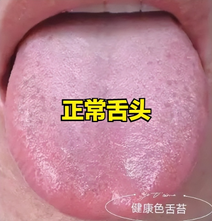 失眠舌头发涩是什么征兆,经常失眠舌苔白