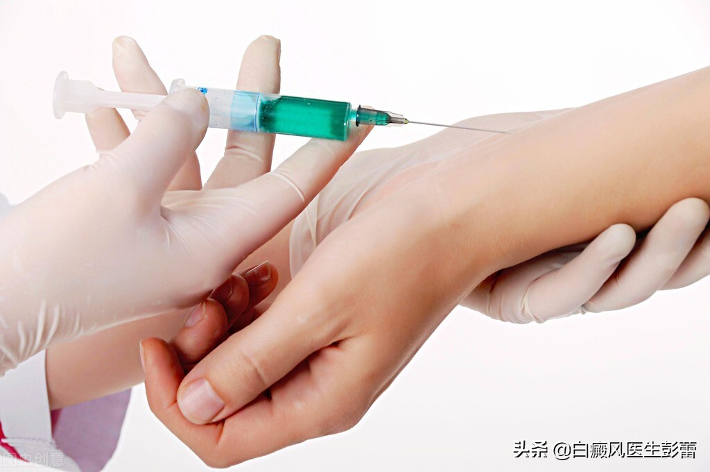 白癜风的用药,白癜风用药中药配方