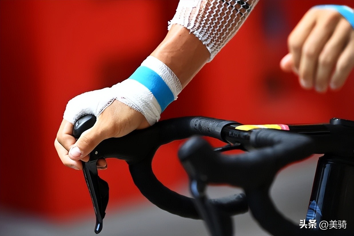 汽车事故处理的7个技巧,一般骑车摔伤怎么处理伤口