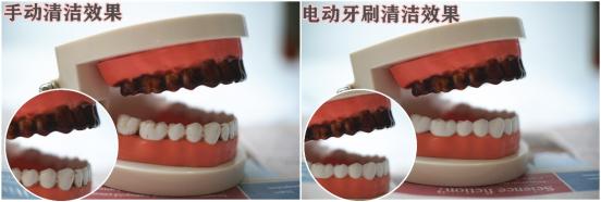 电动牙刷注意事项这三类人要慎用,电动牙刷安全问题大全