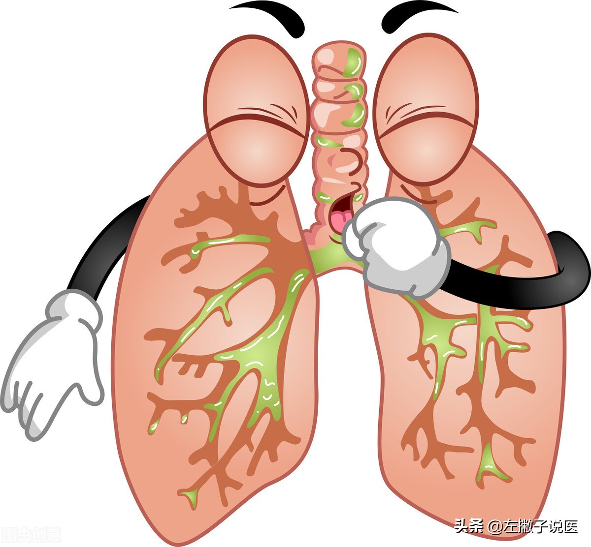 嗓子有痰咳不出来怎么快速祛痰,嗓子痰多怎么祛痰最好最快