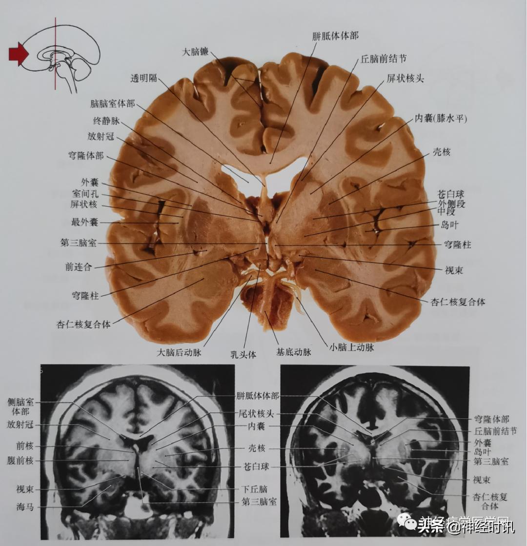 ct袖珍断层解剖图谱最新版,头颅ct断层解剖图谱无水印