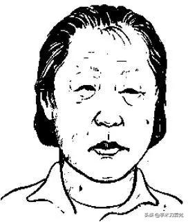 突然全身就肿了是什么原因,身体肿是什么疾病的征兆