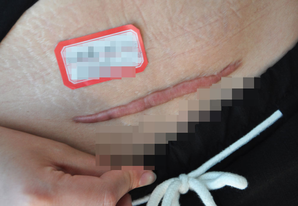 郑州第二中医院张子春,张子春郑州二中院医生