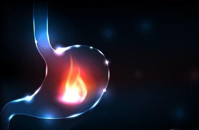 睡眠不好失眠多梦什么原因,失眠多梦睡眠质量差怎么调理