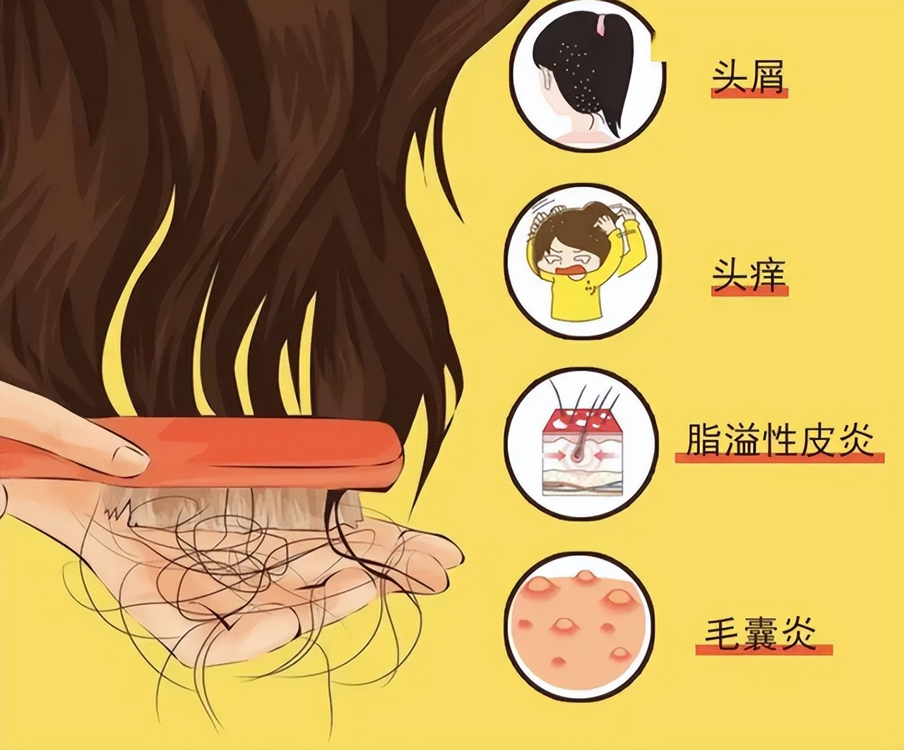 头皮上经常长脓包和疙瘩,是怎么回事?医生:或和这3种问题有关