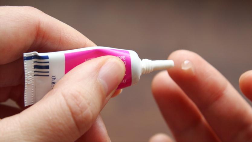 红霉素软膏可以治疗手上老年斑,红霉素软膏可以去除老年斑么