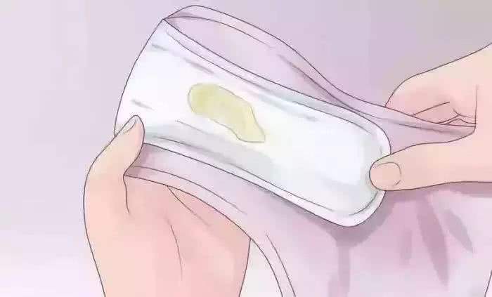 裤子上白带发黄是什么原因,小腹胀痛白带发黄是什么妇科病