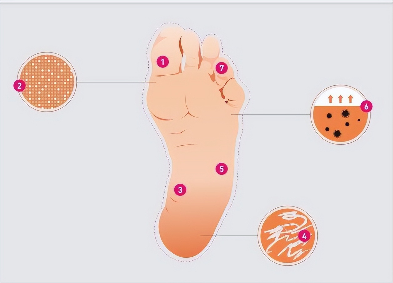 男生脚臭还是女生脚臭,是女生脚臭还是男生脚臭