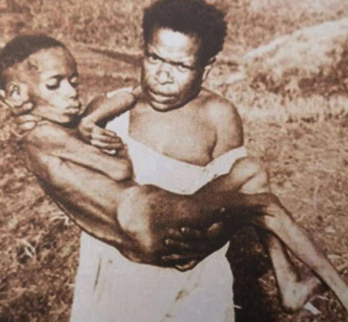 致死率100%！朊病毒烹煮杀不死，无药可救，感染后究竟有多恐怖？