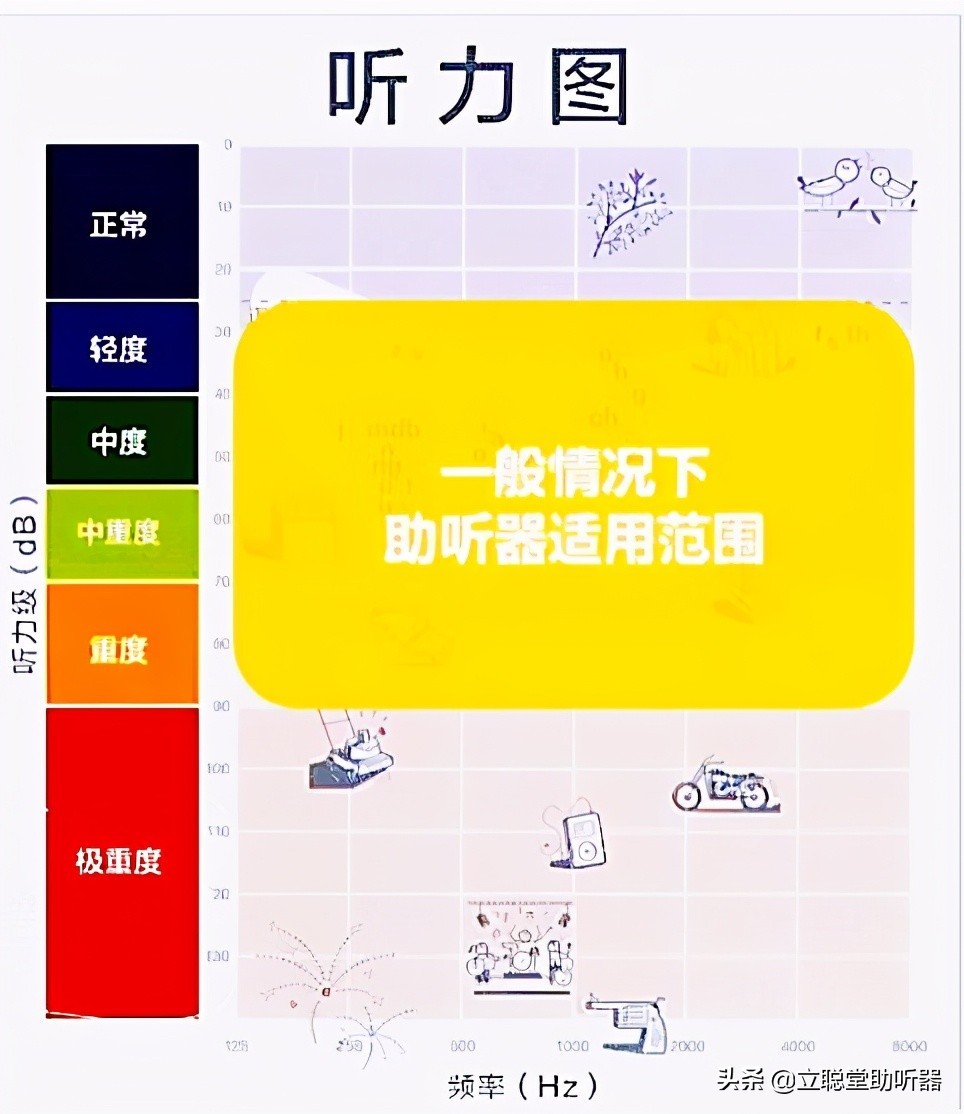 耳聋重度带助听器管用吗,重度耳聋有必要佩戴助听器吗