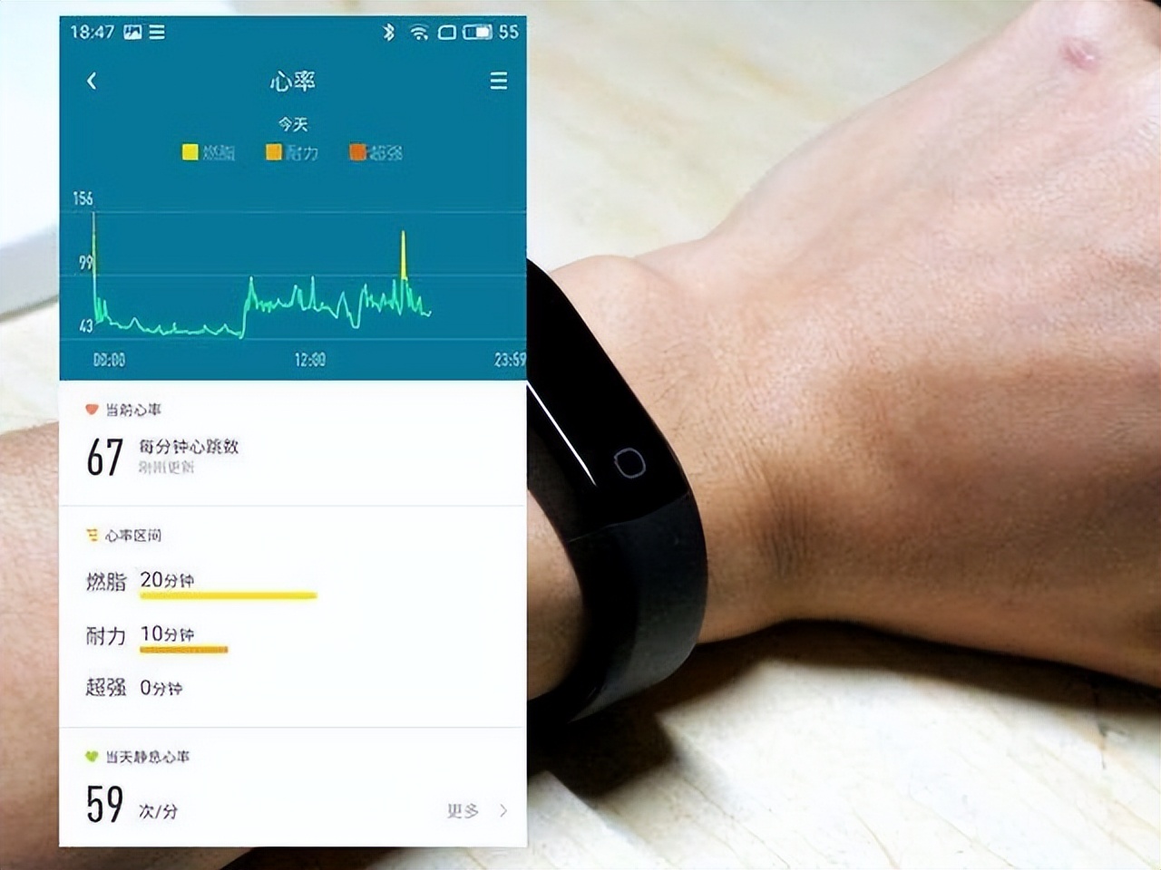 心脏正常心率慢的原因及治疗方法,了解心脏健康先了解心率