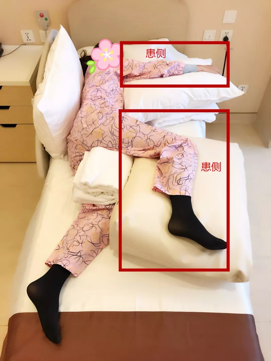 脑卒中恢复期的康复治疗,脑卒中患者的康复治疗方案