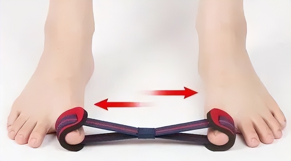 拇趾外翻注意事项,拇外翻要注意哪些事项