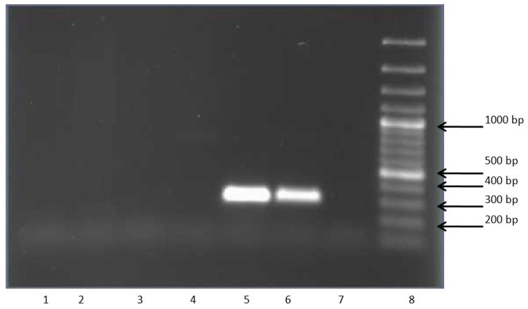 放线菌菌剂的作用包括哪些,放线菌代谢产物的作用