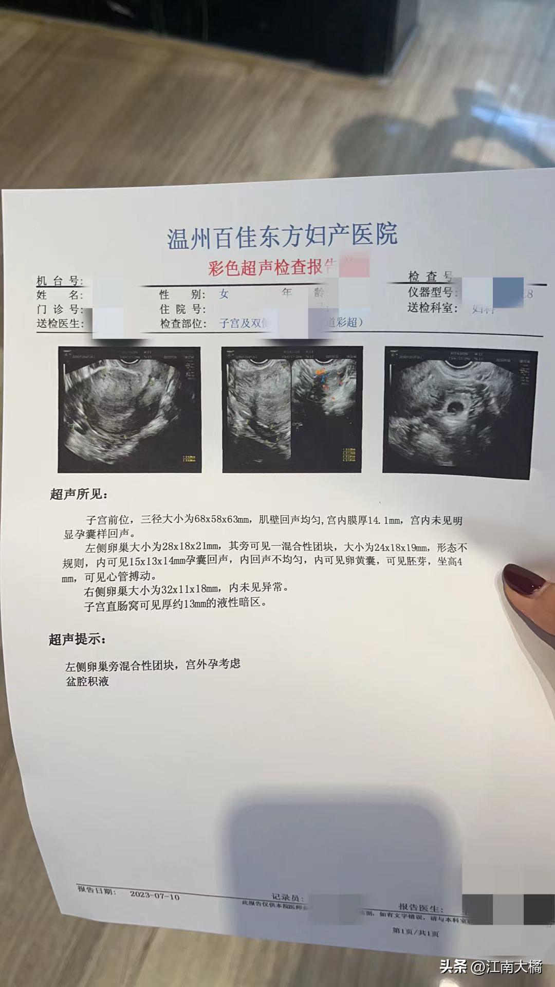 温州医科大学附属第一医院误诊,温州十大黑心医院排名