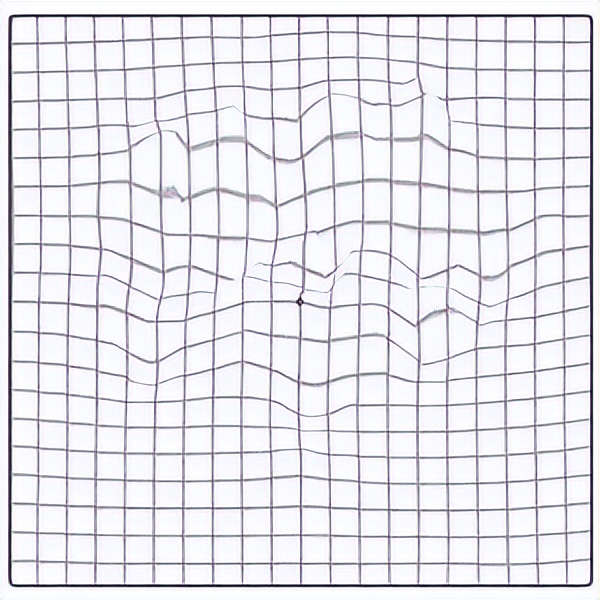 视百年可以治视神经萎缩吗,视百年眼科怎样