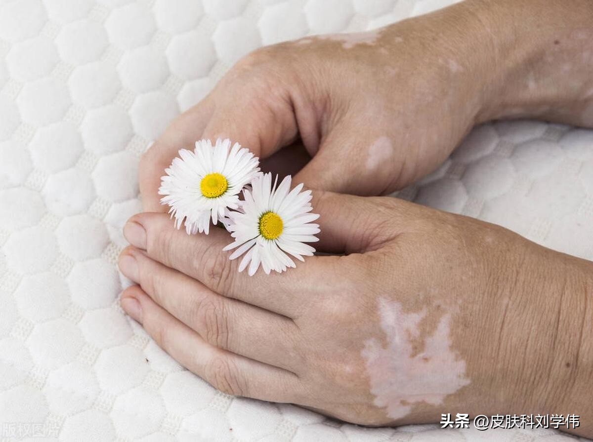 涓堝か韬笂鍑虹幇鍚荤棔,涓堝か韬笂鐨勫惢鐥曞ぇ缁撳眬