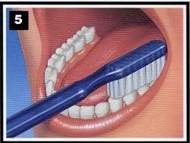 我们的目标是没有蛀牙出处,有没有保护牙齿不蛀牙的办法