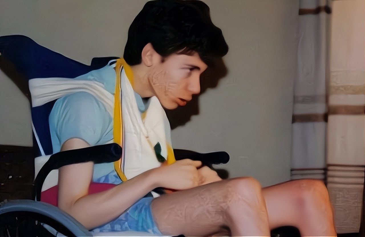 幽灵男孩马丁卧床14年,幽灵男孩马丁患病卧床