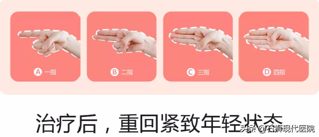 “快看她尿裤子了！”3D生物束带紧缩术帮你解决这些“社死瞬间”