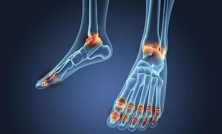 什么是痛风？身体出现痛风的前兆有哪些？痛风有哪些治疗方法？