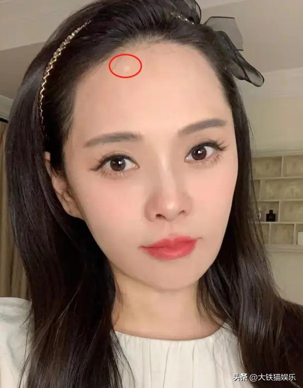 割完双眼皮的变化女,割了双眼皮的女明星