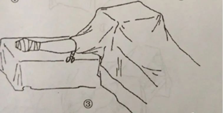 外科手术消毒、铺巾操作，做好这几个细节事半功倍