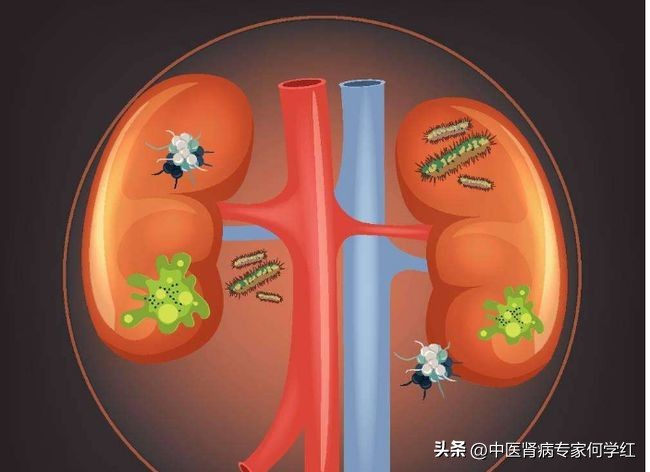 肾毒中药,排肾毒中药