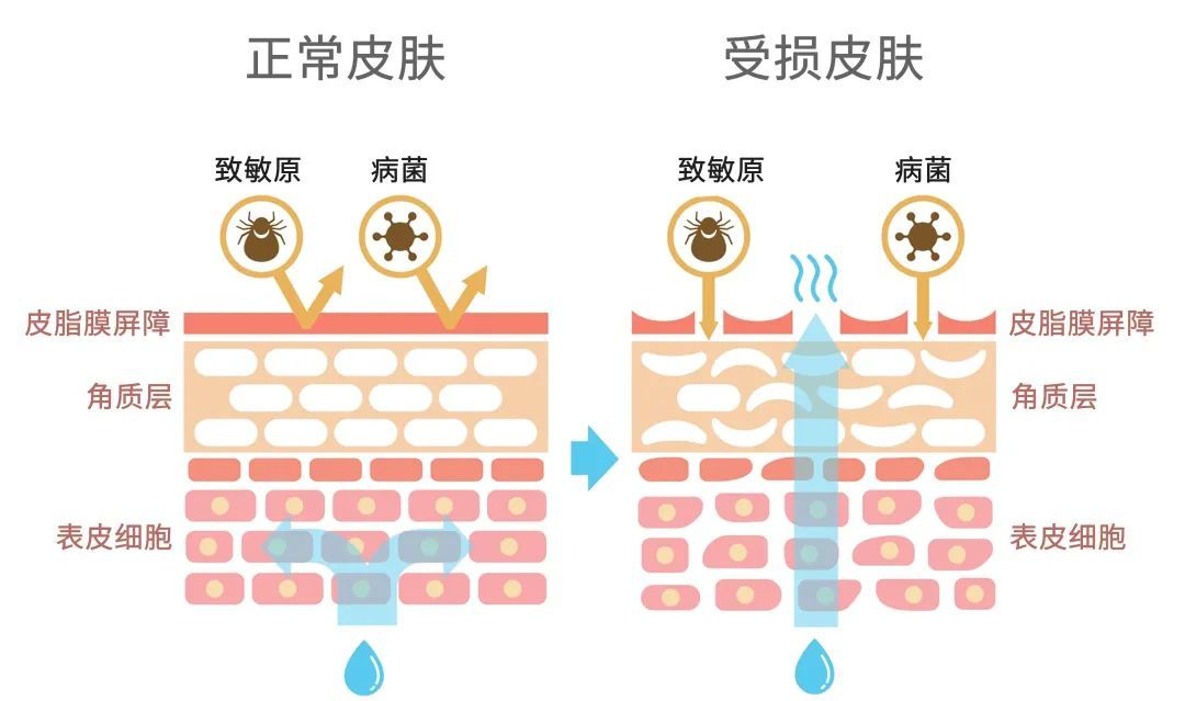 脸上疙疙瘩瘩但不是闭口,脸上疙疙瘩瘩是闭口吗