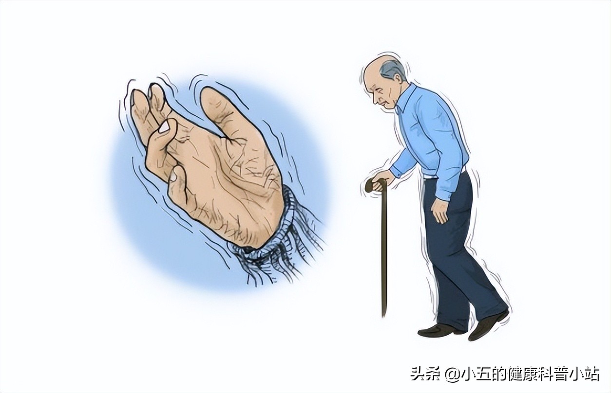 普萘洛尔治疗高血压用法用量,普萘洛尔治疗特发性震颤的用量